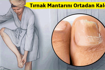 Tırnak Mantarını Ortadan Kaldıran Mucize Çözüm 4 tırnak mantarını ortadan kaldırın