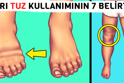 tuz kullanma belirtileri