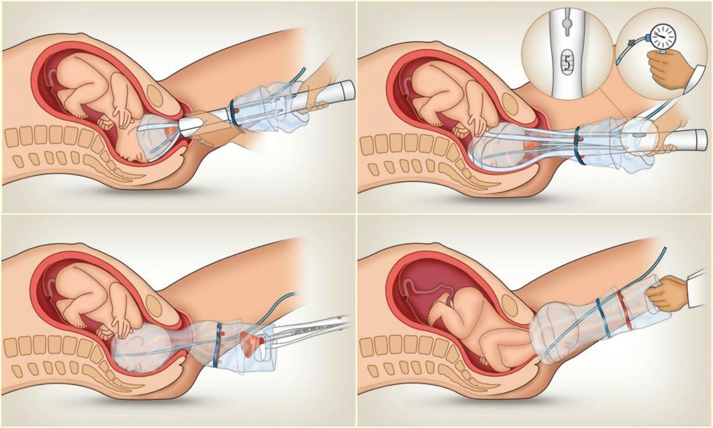 Bu İcatlar Hayatınızı Kolaylaştıracak 26 25odon