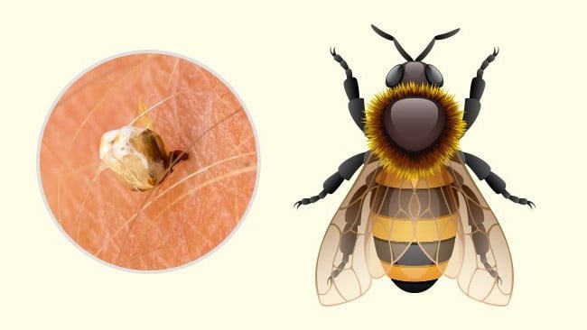Dikkat Etmeniz Gereken 10 Böcek Isırığı 3 bal arisi