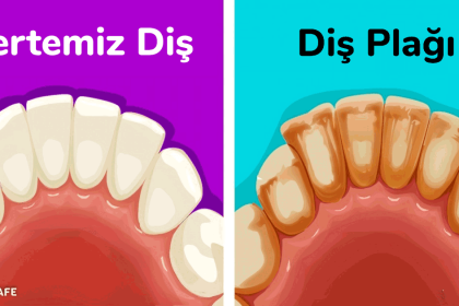 diş plağı temizleme