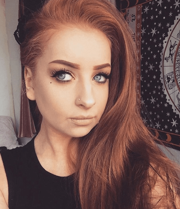 Egzamadan Tamamen Kurtuldu ve Sırrını Açıkladı 3 egzemalı kadın