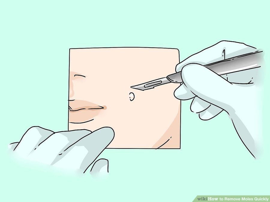 Benler ve Güneş Yanıkları ile İlgili Doğru Bilinen Yanlışlar 9 neşter