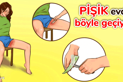 pişik nasıl geçer