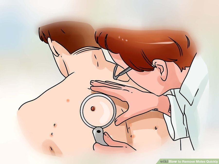 Benler ve Güneş Yanıkları ile İlgili Doğru Bilinen Yanlışlar 2 sırt beni