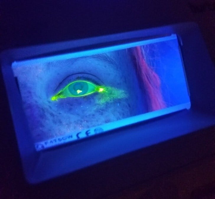 Bu Bilgileri Öğrendiğinizde Dünyaya Çok Farklı Bir Gözle Bakacaksınız 4 uv ışık altında göz