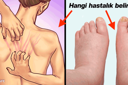 vücudumuzun bize uyarıları