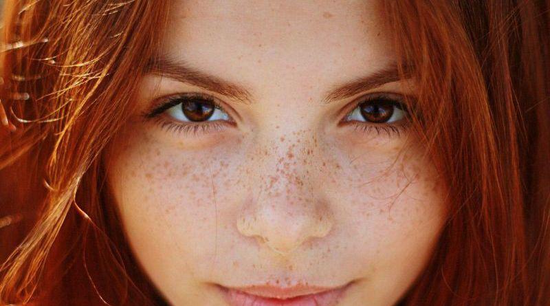 Benler ve Güneş Yanıkları ile İlgili Doğru Bilinen Yanlışlar 8 çil