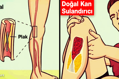 doğal kan sulandırıcı