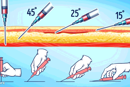 doğru iğne nasıl yapılır