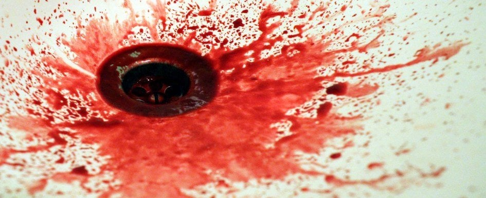 Bu Belirtiler Kanserin İşareti 9 lavabodaki kan