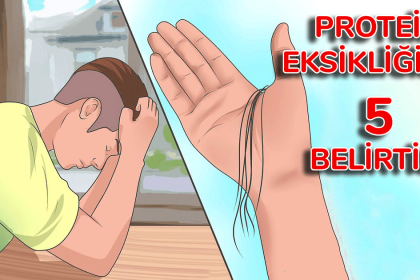 protein eksikligi