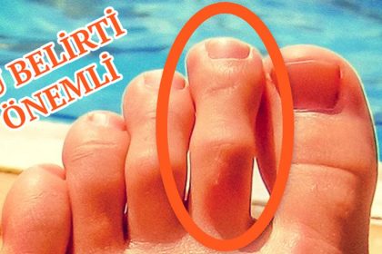 vucuttaki belirtiler