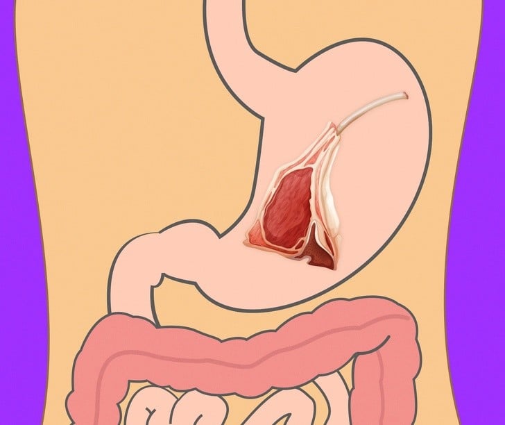Yedikleriniz Midenizde Ne Kadar Sürede Sindiriliyor 16 kuzu eti