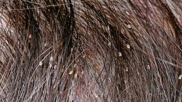 Evde Uygulanan 10 Yanlış Doğal Tedavi 11 bit