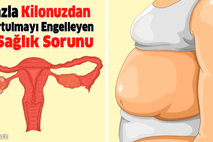 fazla kilolardan kurtulmak