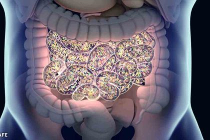 kabizliga ne iyi gelir 1