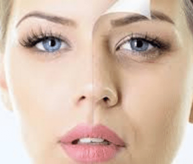 Yüzünüze Zarar Veren 10 Yaygın Cilt Bakımı 3 kimyasal peeling