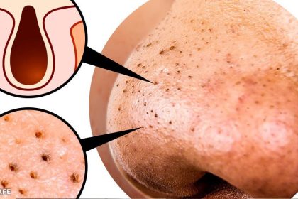 10 adımda 15 yaş gençleşin