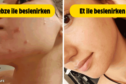 4 Yıllık Vegan Diyet Yüzünden Sağlığından Olan Blog Yazarı 10 vegan beslenme et ile beslenme