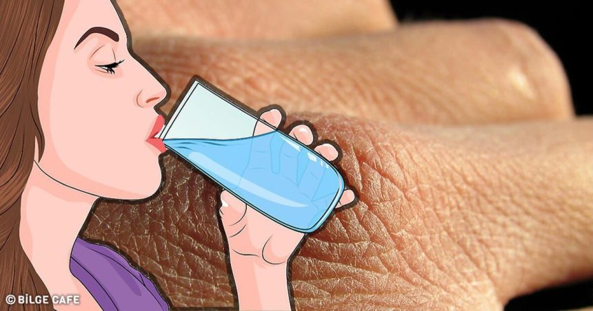 Yeteri Kadar Su İçmediğinizi Gösteren 8 Belirti 34 su içmediğinizde oluşan belirtiler