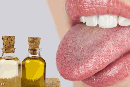 Ağız Yarasına Ne İyi Gelir? 24 ağız yarasına ne iyi gelir