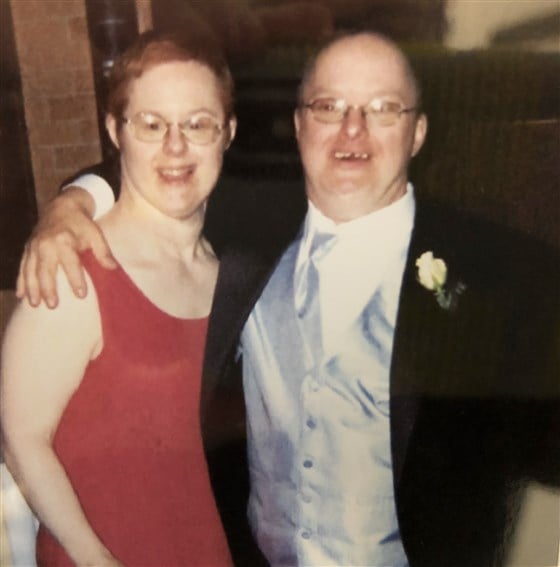 Down Sendromlu Bu Çift Tam 25 Yıllık Evli 3 cift2