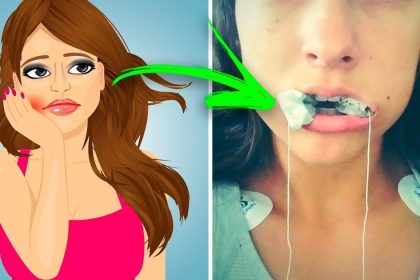 dis agrisini gecirme