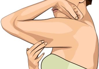 kollardaki fazlalık