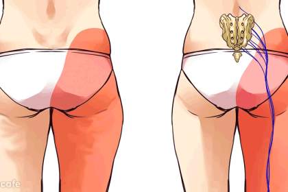 Lenf Kanseri Olmamak İçin 7 Egzersiz 20 lenf tıkanıklığı