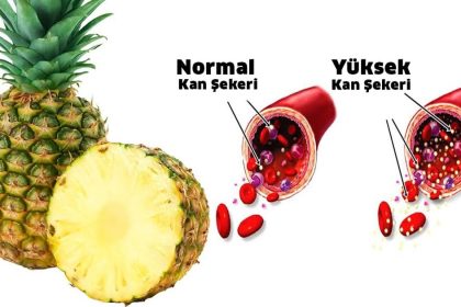Şeker Hastaları Ananas Yiyebilir Ama 1 Şartla 14 ananas kan sekeri