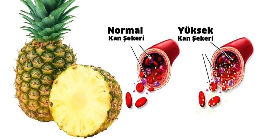 Şeker Hastaları Ananas Yiyebilir Ama 1 Şartla 10 ananas kan sekeri