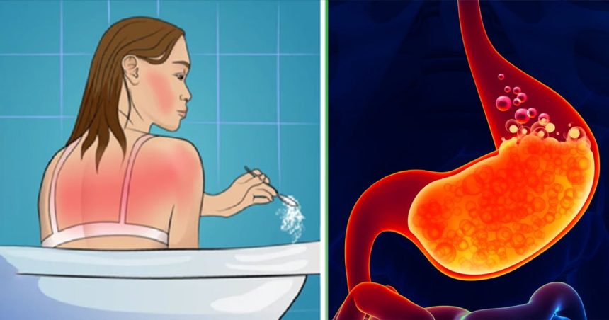 Kabartma Tozuyla harikalar Yaratın! 20 karbonatla yaoilacaklar