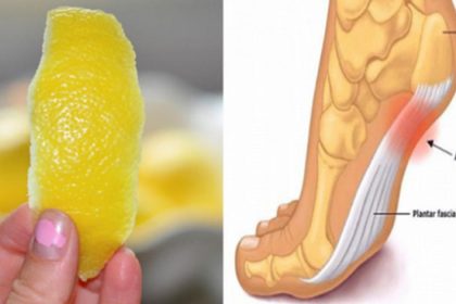 Limon Kabuğu Kullanarak Eklem Ağrılarınızdan Kurtulun 2 limon kabuk