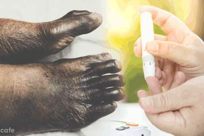 Bu Tavsiyeyi Dikkate Alanlar Diyabet Hastası Olmaz 4 şeker hastası