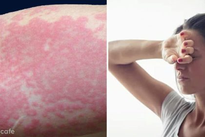 Vücudunuzun Stres Altında Olduğunun Göstergeleri 10 vucudumuz stres altinda mi