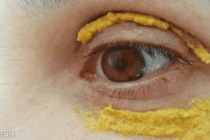 Zerdeçalı Gözlerinin Etrafına Sürenler Bir Daha Vazgeçmiyor 24 zencefili göz altına sürmek