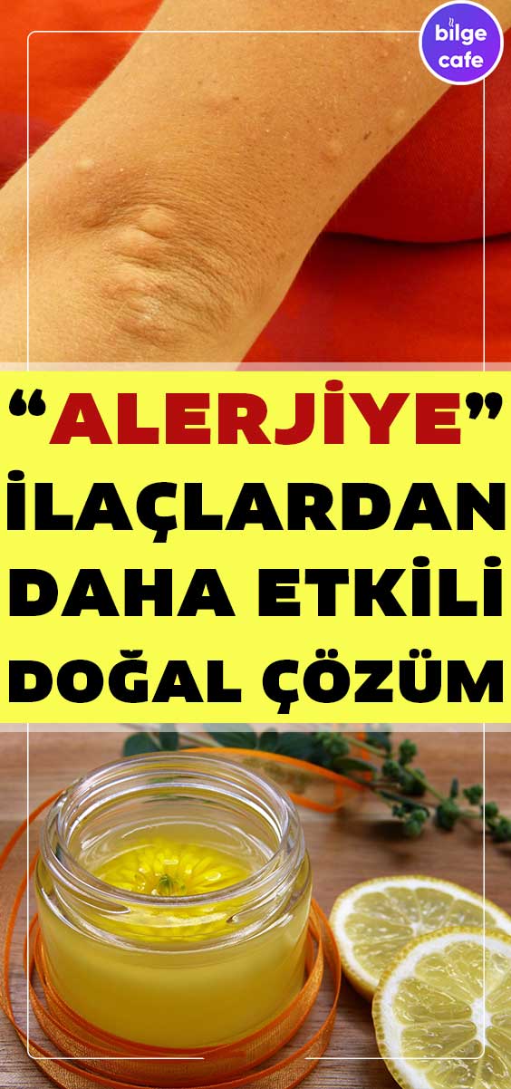 Alerjiden Nasıl Kurtulabilirsiniz? 3 alerji pin