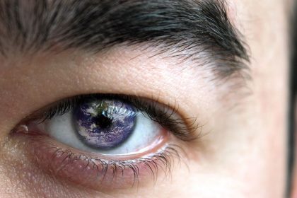Düşük Göz Kapağını Eski Haline Getirmenin Püf Noktası 4 düşük göz kapağı