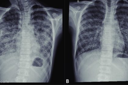 farkinda degiliz bunlari yapmak sagligimizi bitiriyor