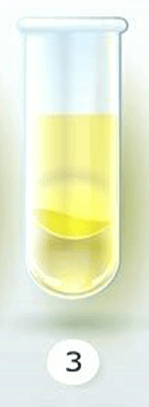 İdrarınızın Rengi Sağlığınız Hakkında Ne Diyor? 4 basit sari idrar rengi