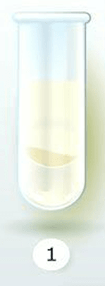 İdrarınızın Rengi Sağlığınız Hakkında Ne Diyor? 2 golgelenme yoksa idrar rengi