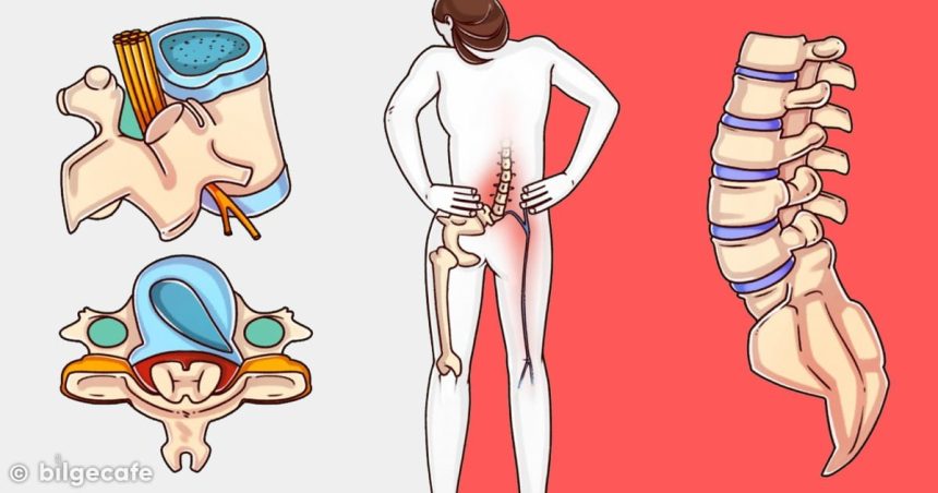 Ünlü Cerrah Açıkladı: Bunları Yapan Asla Kambur Olmaz 40 kambur olmamak için