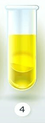 İdrarınızın Rengi Sağlığınız Hakkında Ne Diyor? 5 loj sari