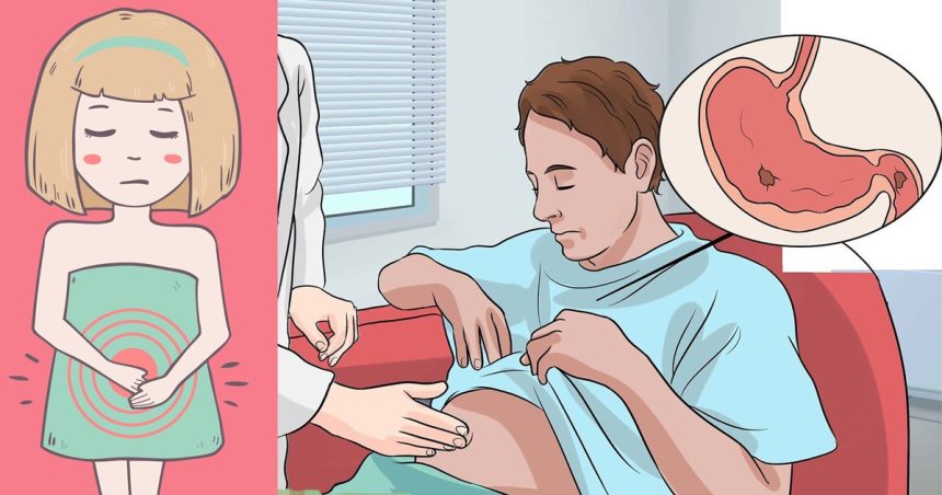 Mide Şişkinliği Ve Hazımsızlığın Asıl Sebebi 34 midesiskinligi asil sebebi