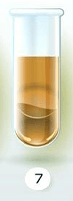 İdrarınızın Rengi Sağlığınız Hakkında Ne Diyor? 8 pembemsi veya gul rengi idrar