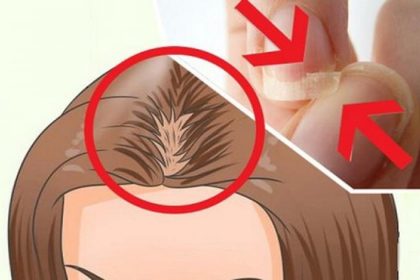 sac dokulmasi tirnak kirilmasi 1