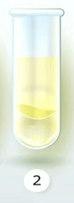 İdrarınızın Rengi Sağlığınız Hakkında Ne Diyor? 3 soluk saman golgelendirme idrar rengi