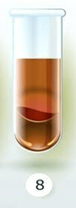 İdrarınızın Rengi Sağlığınız Hakkında Ne Diyor? 9 turuncu idrar rengi