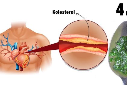 Bu Tariften Sabahları 4 Kaşık Alın, Kolesterole, Tıkanmış Damarlara Veda Edin 18 4 kasik kolesterol